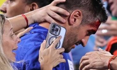 LA HISTORIA DETRÁS DE UNA DE LAS FOTOS ICÓNICAS DE LA BATALLA CAMPAL ENTRE URUGUAY Y COLOMBIA