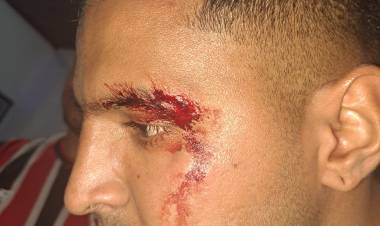 TRES EMPLEADOS POLICIALES LESIONADOS AL INTENTAR APREHENDER A UN CIUDADANO POR ROBO
